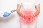 Crohnova choroba: Čo je, prečo vzniká a aké má príznaky?