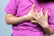 Disekcia aorty: Aké sú príčiny prasknutia tepny a príznaky? + Riziká