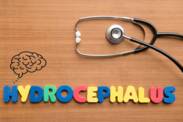 Hydrocefalus: Čo je, prečo vzniká? Aké má príznaky, či následky?