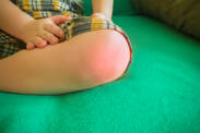 Juvenilná idiopatická artritída: Príznaky reumy, zápalu kĺbov u detí?