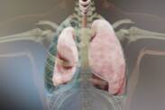 Pneumotorax (vzduch v hrudníku): Príčiny vzniku, príznaky a prvá pomoc