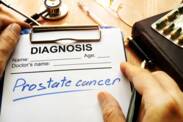 Rakovina prostaty: Príčiny a prvé príznaky. Aká je prognóza liečby?