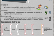 Infografika: Aké druhy zlomenín poznáme