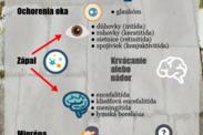 Infografika: Aké sú hlavné príčiny citlivosti na svetlo?