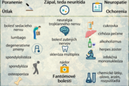 Infografika: Aké sú možné príčiny bolesti nervov?