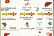 Infografika: Ako sa metabolizuje bilirubín