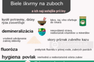 Infografika: Najčastejšie príčiny bielych škvŕn na zuboch