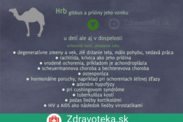 Infografika: Najčastejšie príčiny stojace za vznikom hrbu