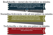 Infografika: Pulzová frekvencia a hodnoty spomaleného, normálneho a zrýchleného pulzu