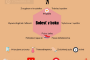 Infografika: Rôznorodé informácie pri bolesti v boku