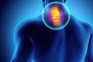 Ako súvisí krčná chrbtica a točenie hlavy? Čo pomôže na závraty?