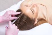 Vlasová mezoterapia: Čo je a aké má účinky, výhody a nevýhody?