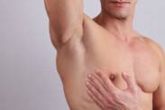 Ako vyzerá Gynekomastia? Zväčšenie prsníka u mužov a jeho príčiny